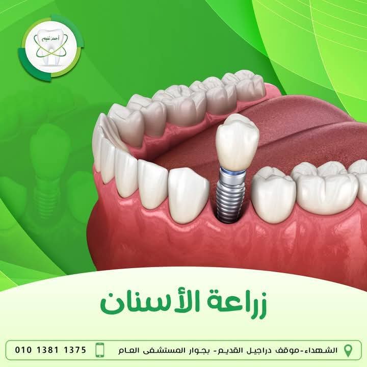 صورة 3 من مركز د احمد غنيم لزاراعه و تقويم الاسنان